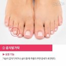 다섯발가락