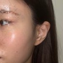 셀럽참 | 고급미관리 레프톤 리프팅 및 셀럽관리 후기 (내돈내산)