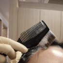 케어로 | 동암역 두피클리닉 찐추천! 실크스토리헤어 탄산수 두피케어로 두피 리셋한 후기