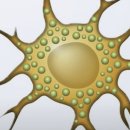 Stellate cell (성상 세포)와 간암, 췌장암 ,복막 전이 ​ 이미지
