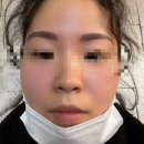 분당 미금역 잔흔제거 후 눈썹문신 솔직후기 | 미금역 브로우원