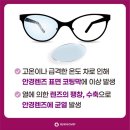 아이세이버 안경 소태점 이미지