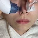 송도피부관리 에스떼리밋 | 송도에스테틱 &#34;송도피부관리 에스떼리밋&#34; 겨울철 건조한 피부에 보습충전 케어