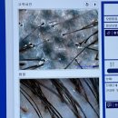 엠지에프용산 | 용산두피탈모관리 엠지에프 용산이촌점 탈모 예방 후기