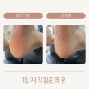 네일트위
