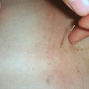 신림자유한의원 | 챗바퀴 다이어트 졸업! 관악구한의원 다녀온 솔직 후기