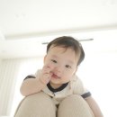 언론기관부설 | 아기 두상 교정 헬멧 5개월 아기 사두증 초진 가격 후기_경북대병원