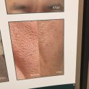 피앤피 | 광주피부관리 피앤피뷰티연구소 이용후기