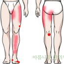 아름나무한의원 네이버블로그