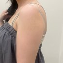 모두병원 | 팔뚝지방분해주사가격, 후기 모두 만족했던 병원 후기