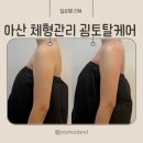 토탈발란스 | 아산 목 어깨관리 체형관리 굄토탈케어 상체관리 후기