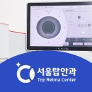 서울탑안과의원 이미지