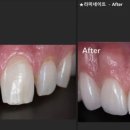 강남삼성치과기공소 이미지