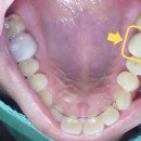 하얀치과기공소 이미지