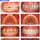 목동중앙치과병원 이미지