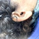 포낙보청기 동작센터 이미지