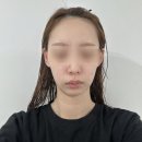 진정 | 샤이니L | 피부진정 물방울초음파 홈케어 후기💧