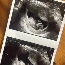 삼성1로 | 임신 초기 산부인과 선택과 조리원 예약 후기