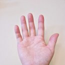 생후 50일 둥이육아 중 손가락 저림& 통증 – 손목터널증후군 진단과 치료 후기