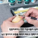 진보치과기공소 이미지
