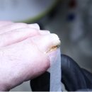 홀드핀칭 이미지