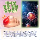 강동성모내과의원 | 서울 구로 발가락 통증이 지속될 때 통풍 검사 내과 진단이 필요할까?