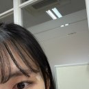 팩트성형외과 돌출점 제거수술 후기(+경과사진)