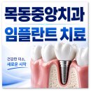 달(DAL)치과기공소 | 목동 오목교 치과 임플란트 하루에 다 끝낼 수 있나요? <의사 답변>