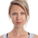 메디로프 이미지