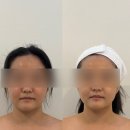 (주)정인 | 정인에스테틱 수성구피부관리 윤곽 두피교정테라피 후기