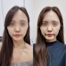 대전웨딩케어 윤곽관리 신부관리 둔산동 에스테티아 후기