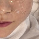 삼일공원로 | 💆🏻‍♀️ 아산피부관리 가람뷰티 : 울쎄라하이푸 3000샷 후기