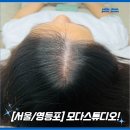 탈모 두피관리[모다스튜디오]만족후기!/영등포신길동 새로오픈한 두피탈모케어샵/영등포미인점효과있는...