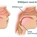 잔기침 계속 잔기침 원인 잔기침 인체 신호 질환 상기도 기침 증후군 기침 원인 기침 관련 질환 치료 이미지