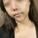 미플 정릉점 | 정릉 피부관리 언굴관리 [미플 정릉점]