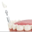 SM치과의원 이미지