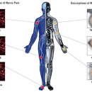 근육통증(Muscle pain) 이미지