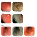 OLYMPUS Evis Lucera CV-260SL/CLV-260NBI Endoscopy System 이미지