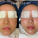 최예란 에스테틱