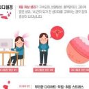 생리양 많음 현상 몸이 보내는 적신호일까 이미지