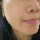 아주속편한의원 | 얀의원 블룸쥬베룩 볼륨 2회차 내돈내산 찐후기