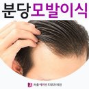 분당모발이식 횡한 두피에서 자신감을 찾아 이미지