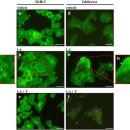 Re:Re:Medium Chain fatty acid(lauric acid) - 코코넛 오일의 항암효과 이미지