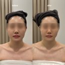 수원에스테틱 예신관리는 에스테틱 다리아 후기