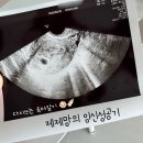 GS25 효성병원점 | 9년만에 다시쓰는 임신, 육아일기 / 대구효성병원난임센터 습관성 유산 노산 둘째 자연임신후기