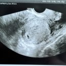 용한의원 | [공지] 부산 힘찬한의원 다녀온 후 한방에 임신 성공한 내돈내산 찐 후기