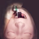Laryngoscope 이미지