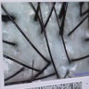 탈모야안녕 | [잠실탈모] 간지러운 두피 고민 해결! 모바이오 송파문정점 방문 후기