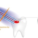 올바른 치과의원 이미지