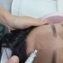정원장의 모공세척테라피 이미지